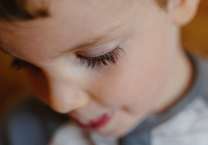Eyelash In Eye: How to Safely Remove and Other Tips