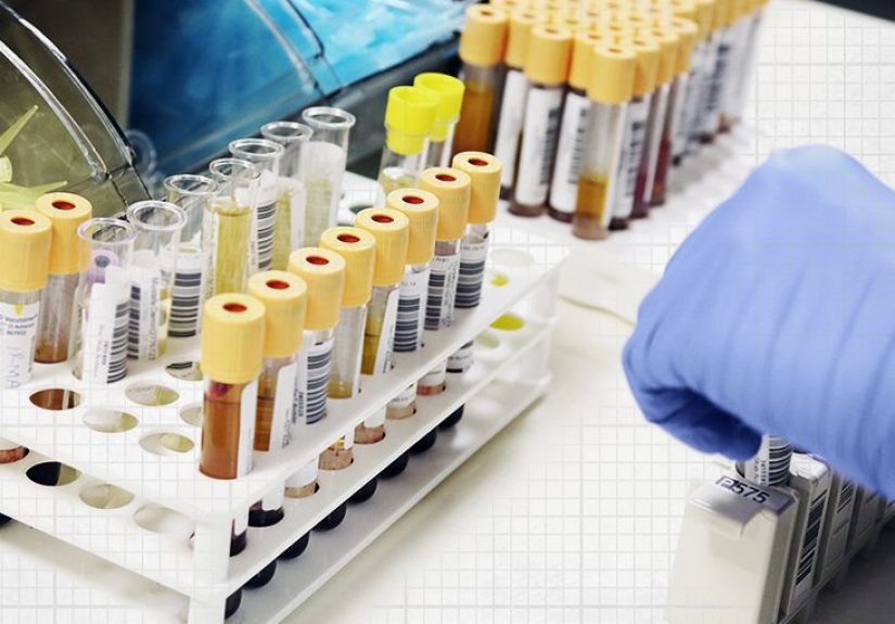 Leukocytes in urine: A sign of urinary tract infection?