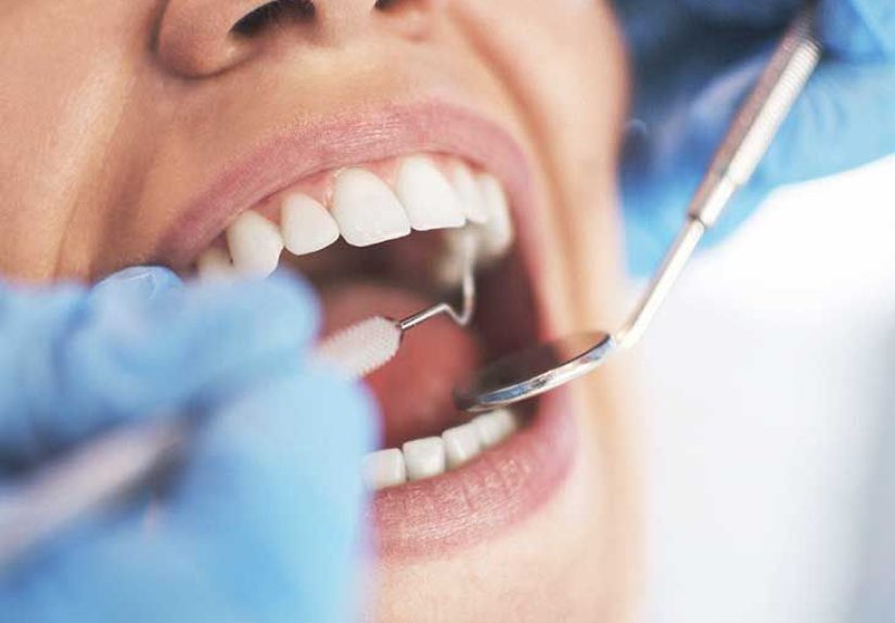 Periodontitis: Symptoms, Causes, and Treatments