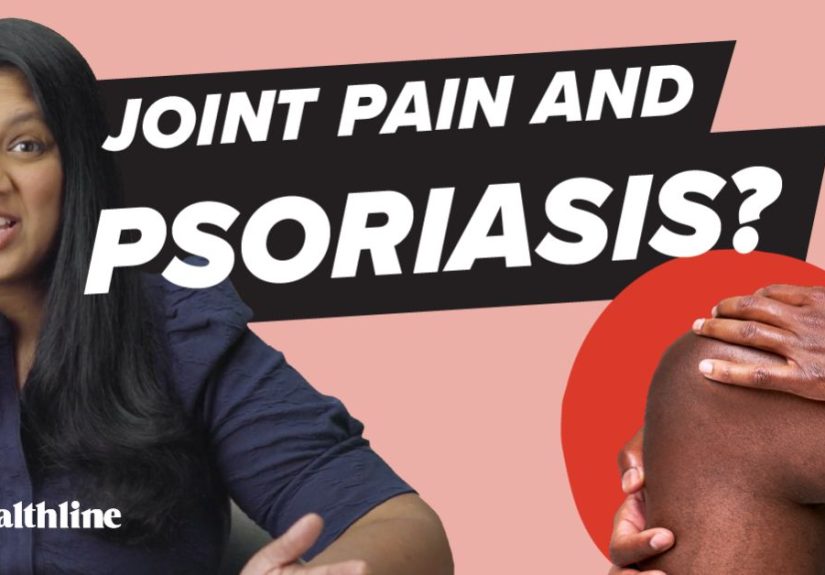 The Surprising Link Between Psoriasis and Other Medical Conditions