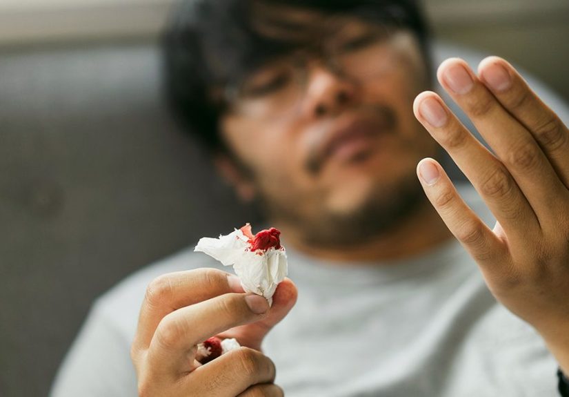 What Is Vitamin K Deficiency Bleeding?