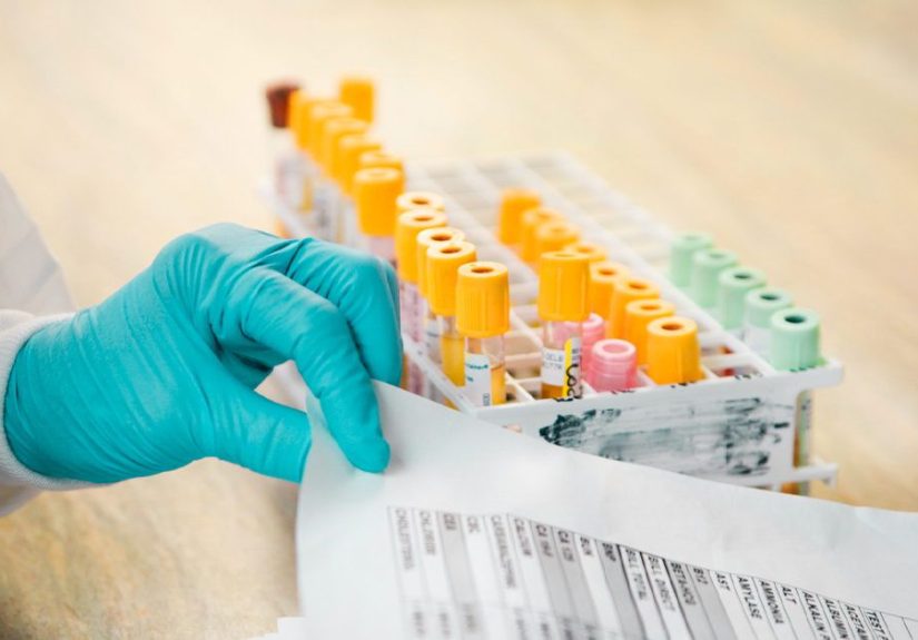 Are COVID-19 Tests Covered by Medicare?