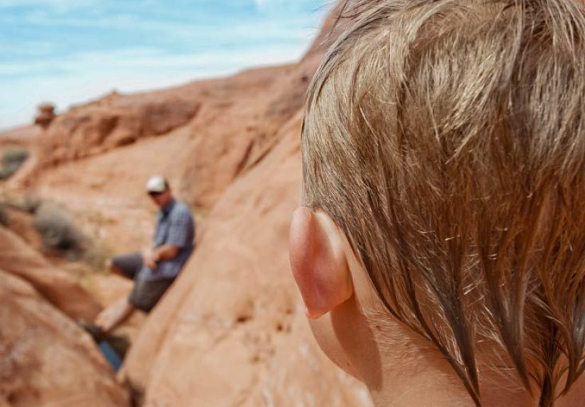 Ears That Stick Out: Causes and Treatment