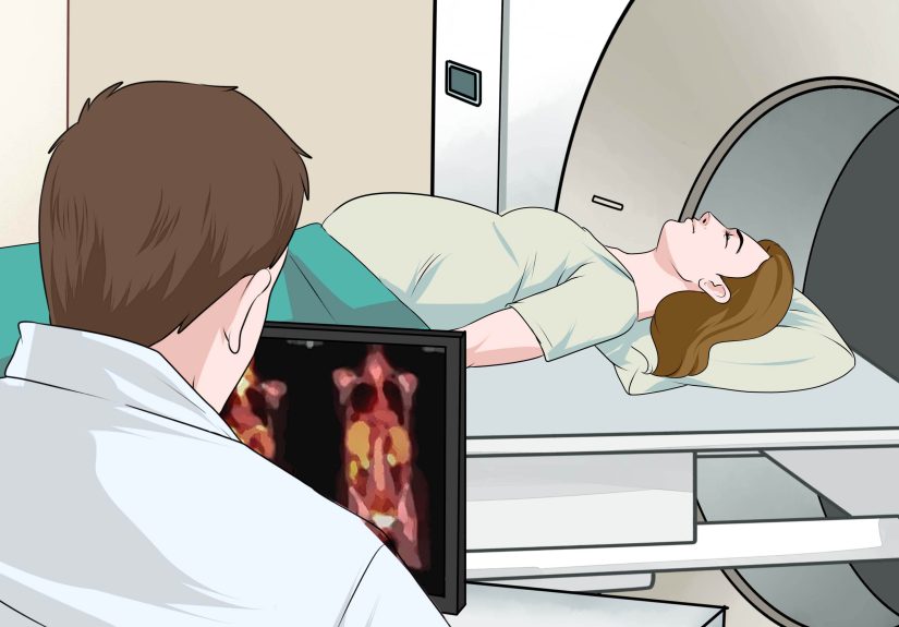How to Detect Appendicitis During Pregnancy