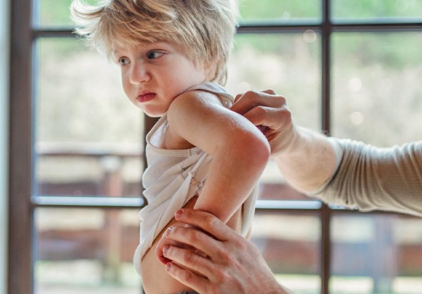 Mold Rash Symptoms, Causes, Diagnosis, and Treatment