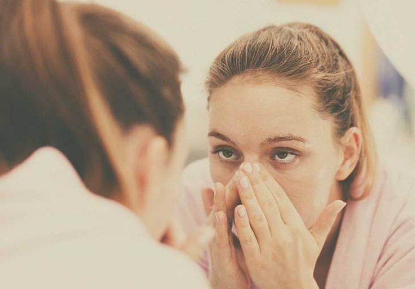 Nose Acne: Causes, Treatment, and More
