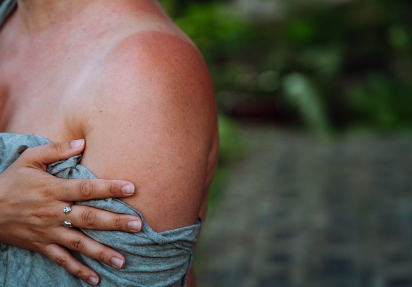 Skin Redness: Causes, Diagnosis, and Treatment