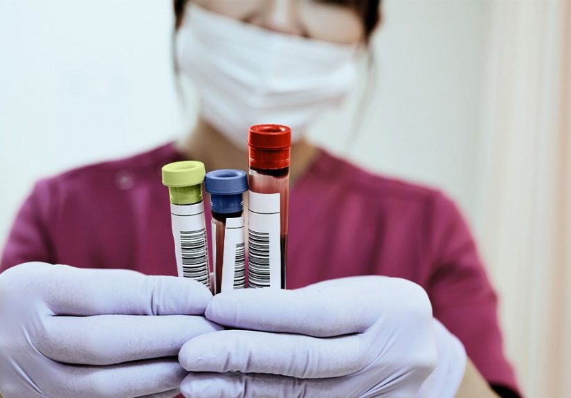 TTP vs. ITP: Comparisons and More