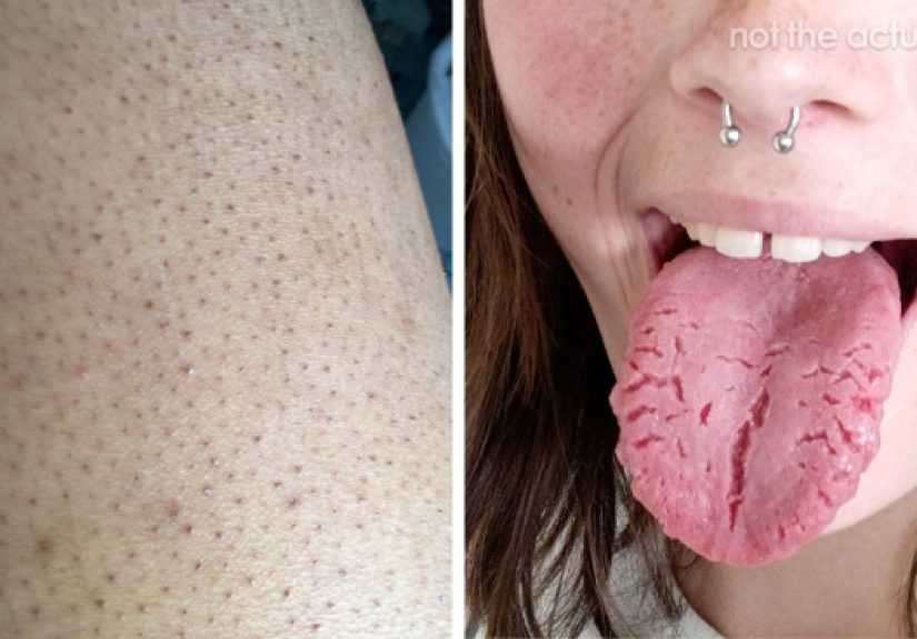 50 Things People Thought Were ‘Normal’ About Their Bodies Until They Realized They Weren’t