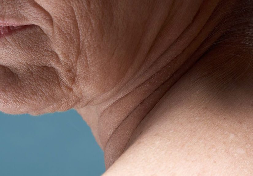 Bone Spurs in the Neck: Symptoms, Causes, and Treatment