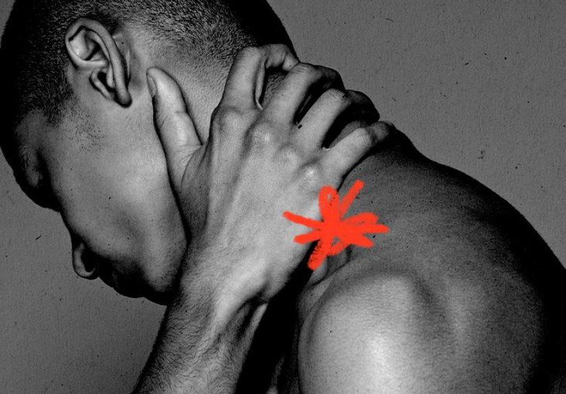 Brachial plexus injury: Causes, diagnosis, treatment, and more