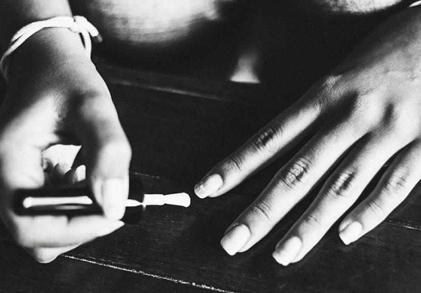 Brittle nails: Causes, treatment, and nutrition