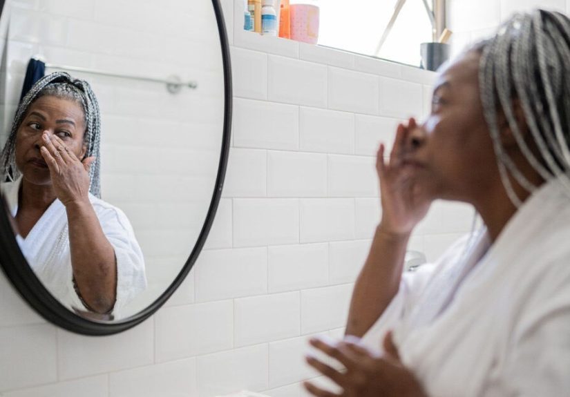Can You Pop Rosacea Bumps? Why You Should Avoid It