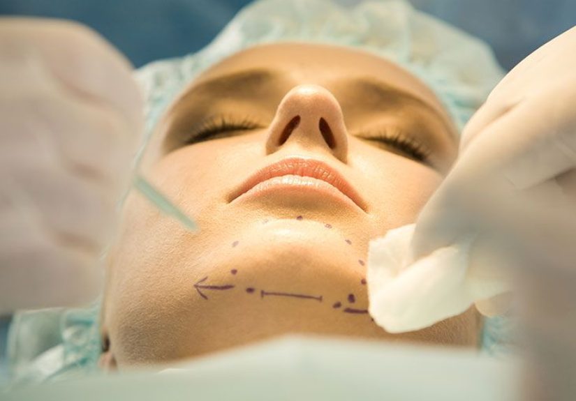 Genioplasty: Types, Procedure, and Recovery
