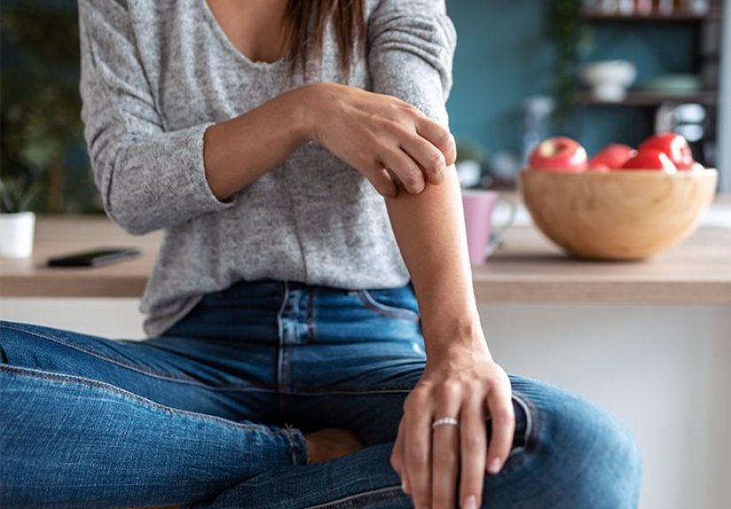La psoriasis, Â¿debilita el sistema inmune?