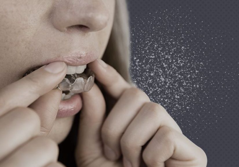 Mouth guard for grinding teeth: Options and when to see a dentist