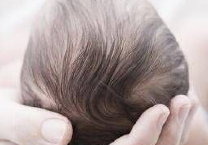 Pfeiffer syndrome: Symptoms, causes, and outlook