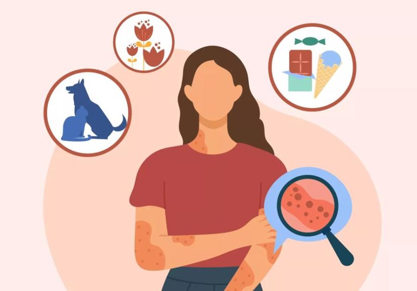 What To Do for an Allergic Reaction
