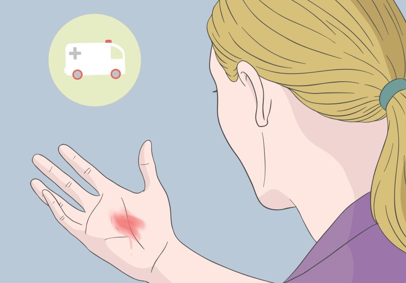 4 Simple Ways to Treat Gastritis Naturally