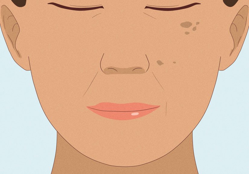 Can I Use Salicylic Acid with Retinol? Expert Answers & Advice