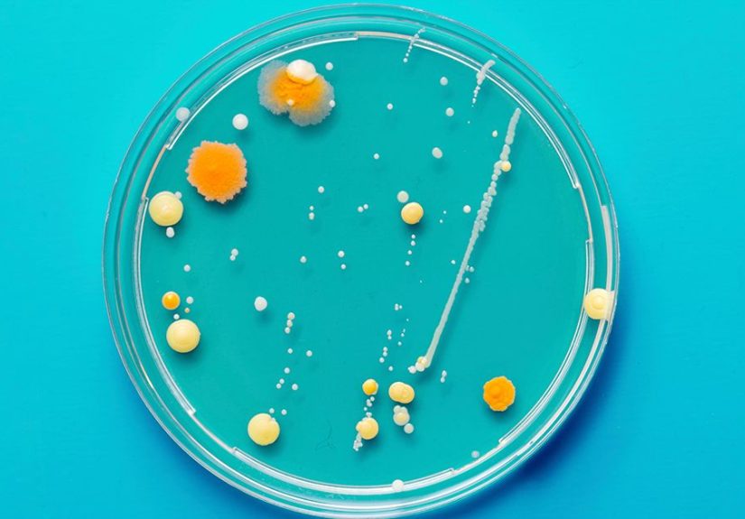 Chlamydia Species: Transmission, Complications, Prevention