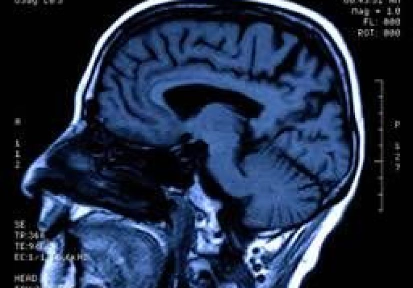 Female Orgasm - Brain Activity Captured In FMRI Imaging Device