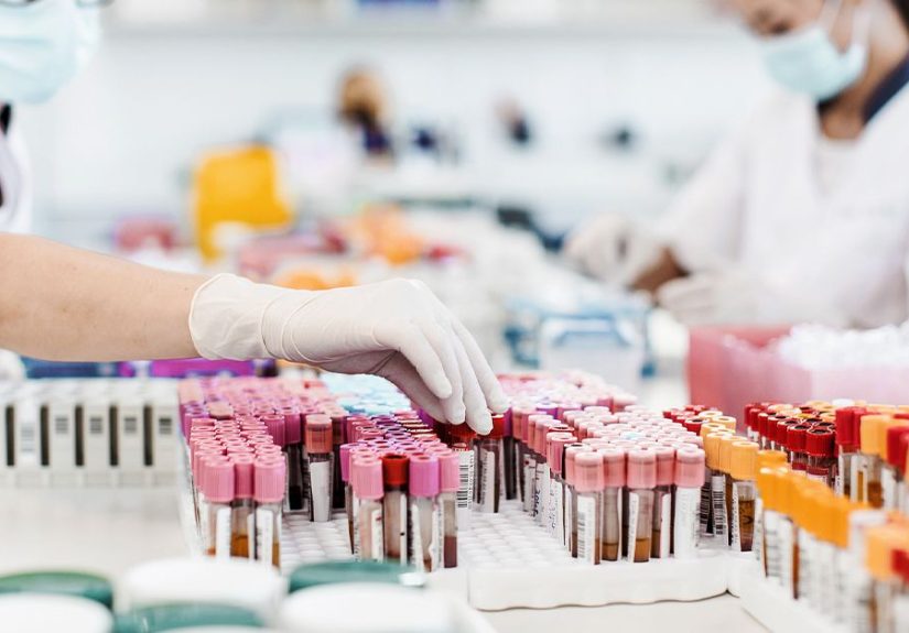 HIV-1 vs. HIV-2: Transmission, Diagnosis, Treatment