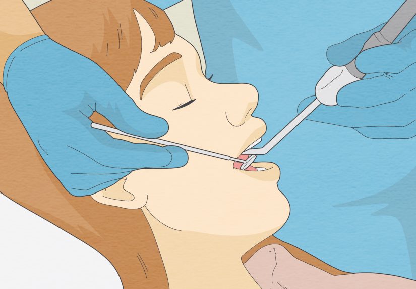 How to Brush Your Teeth With Braces On