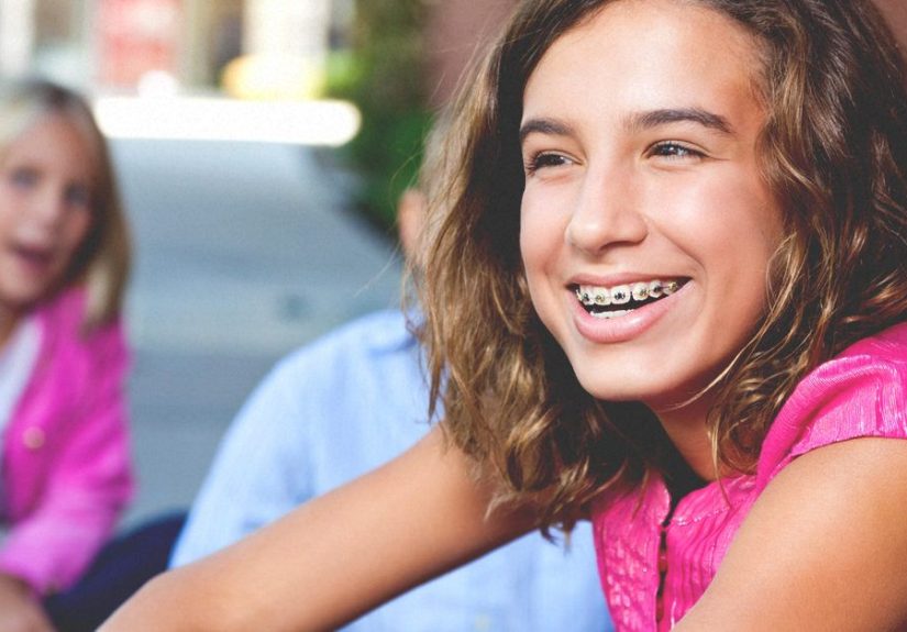 How to Floss with Braces: Methods, Tips, and More