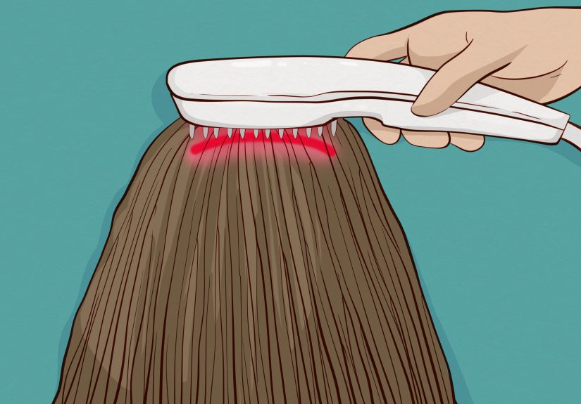 How to Regrow Hair After Hair Loss (Women)