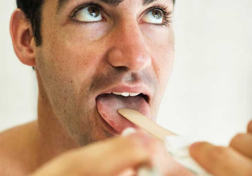 Is Thrush Contagious? Prevention, Complications and More