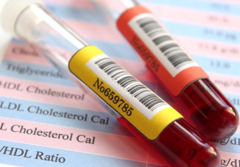 Lipid Panel Cholesterol Test: Ranges, Procedure, and Results