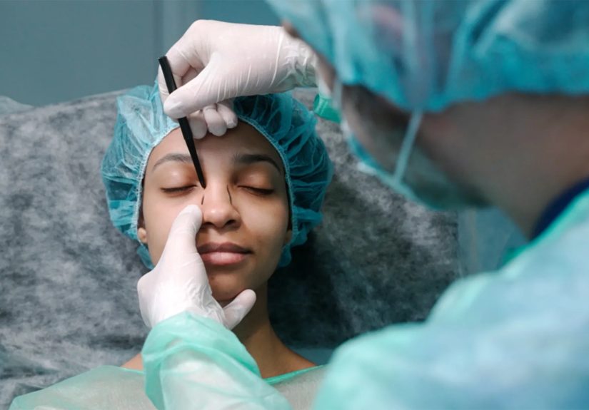 Nose Job & Rhinoplasty: Procedure, Benefits, Risks,