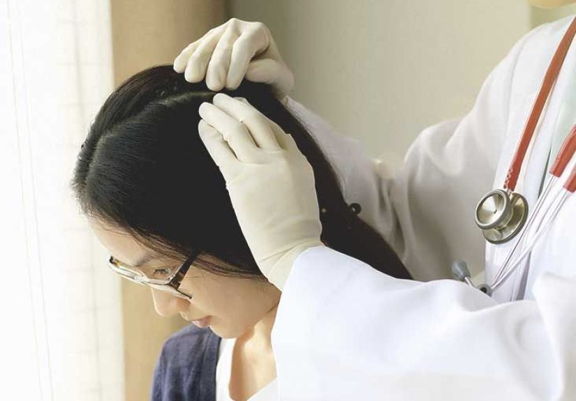 Pilar Cyst: Causes, Treatment, and More