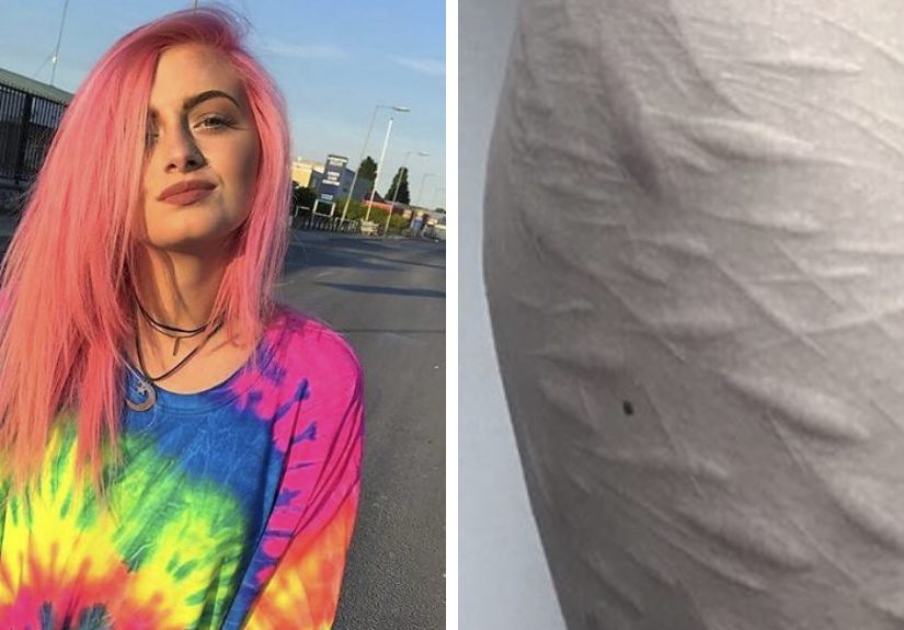 19 Y.O. Found A Tattoo Artist To Help Cover Self-Harm Scars