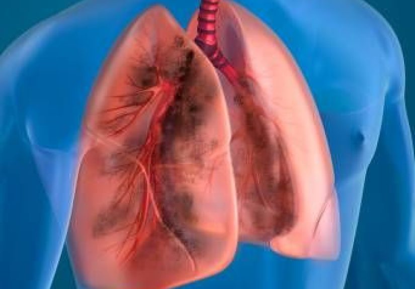 Bronchospasm: Causes, Symptoms, and Diagnosis