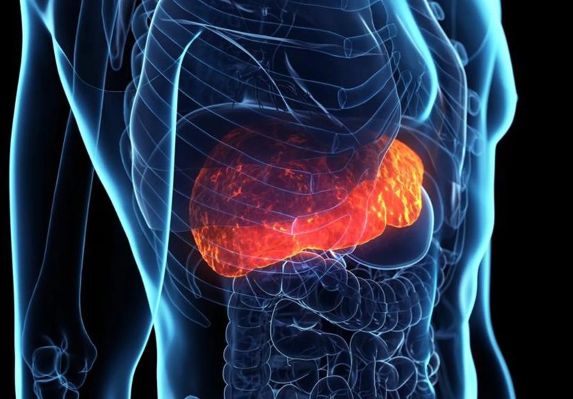 Diabetes Association Updates Liver Disease Screening Guidelines