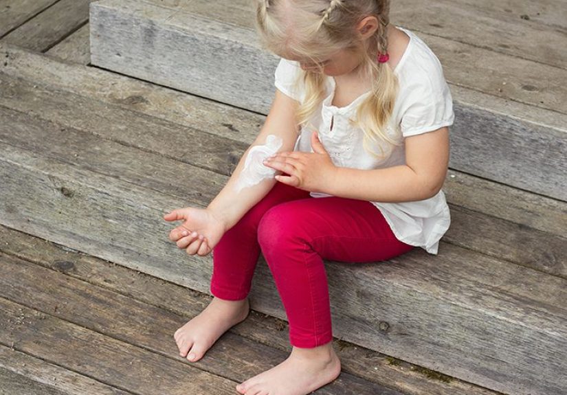 Eczema (Atopic Dermatitis): Causes, Treatment, and More